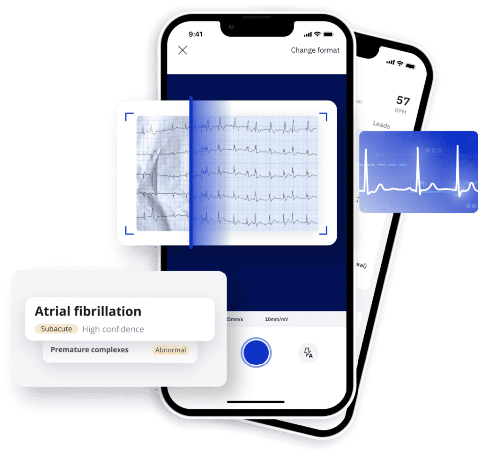 L'IA au service des pathologies cardiaques